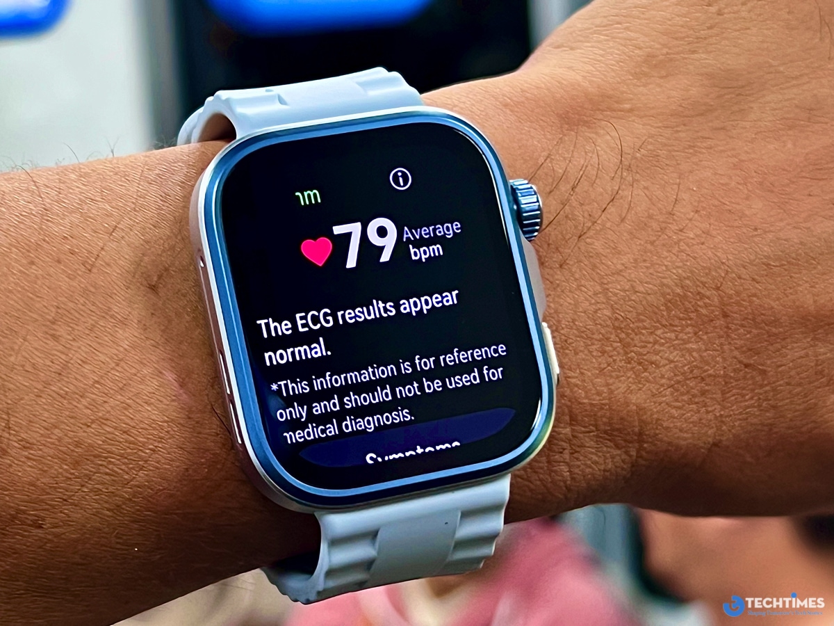 Kết quả đo ECG hiển thị trực quan ở màn hình đồng hồ, đồng thời thông tin chi tiết được tổng kết một cách khoa học bên trong ứng dụng trên điện thoại.